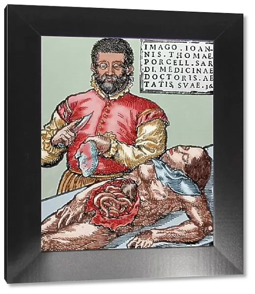 John Thomas Porcell (1528-ca. 1580). Spanish doctor