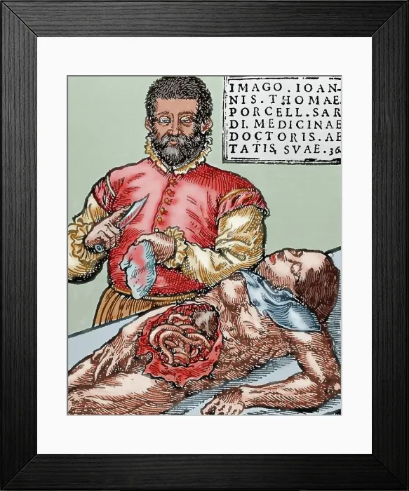 Framed Print : John Thomas Porcell (1528-ca. 1580). Spanish doctor Framed Print : John Thomas Porcell (1528-ca. 1580). Spanish doctor