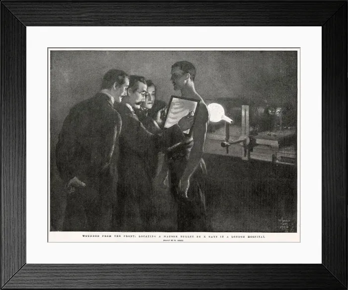 Framed Print : X-ray - Soldier with Bullet Bound Being Examined 1900 Framed Print : X-ray - Soldier with Bullet Bound Being Examined 1900