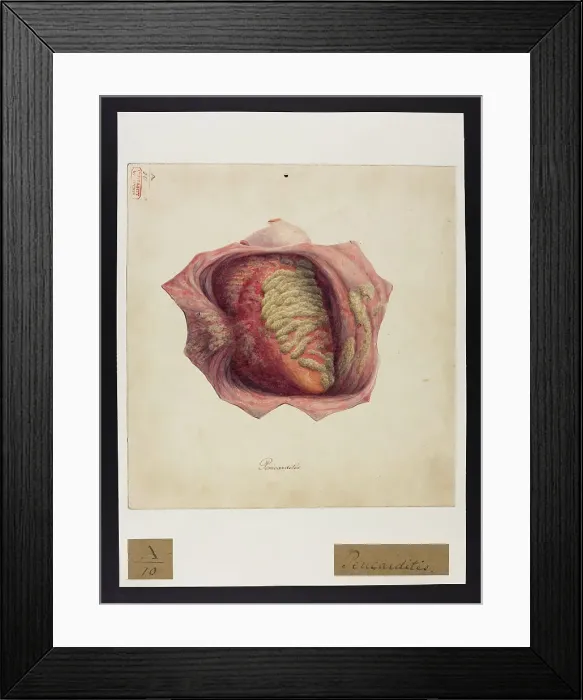 Framed Print : 13741354 Framed Print : 13741354