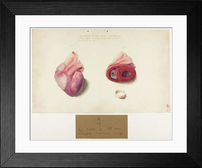 Framed Print : 13741357 Framed Print : 13741357