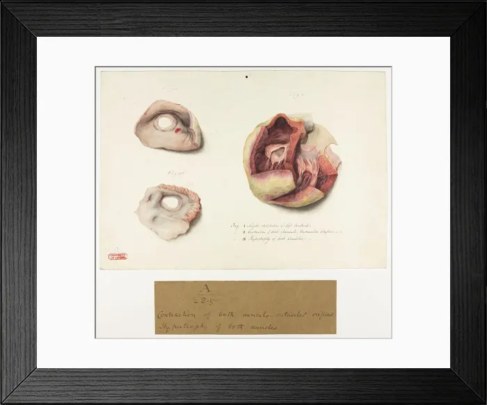 Framed Print : 13741360 Framed Print : 13741360