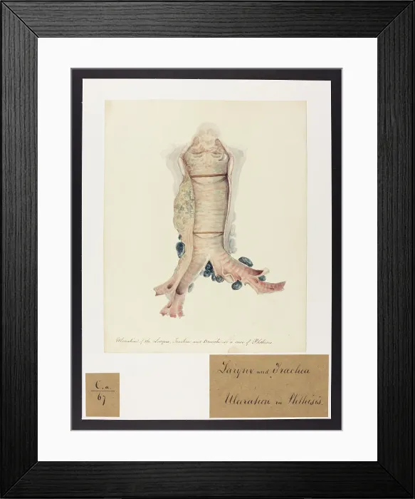 Framed Print : 13741454 Framed Print : 13741454