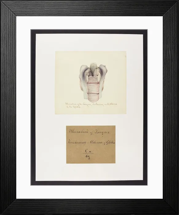 Framed Print : 13741456 Framed Print : 13741456