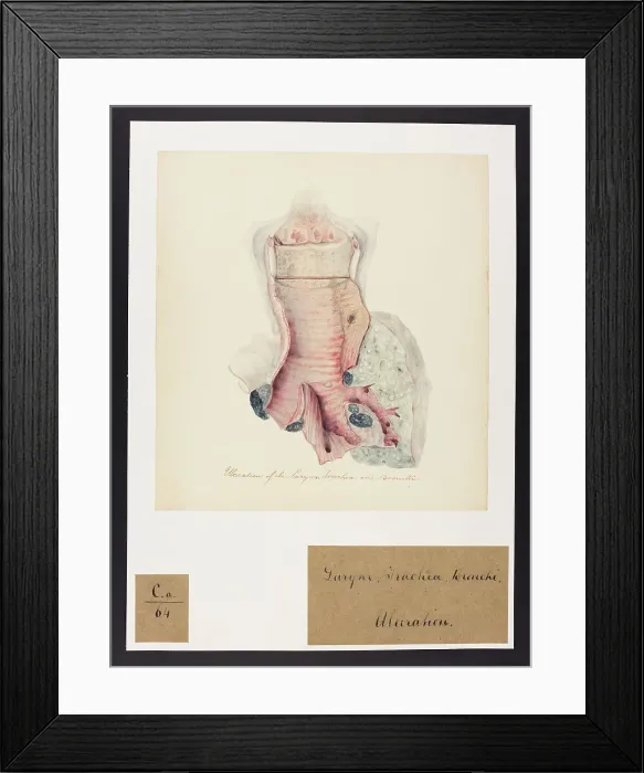 Framed Print : 13741451 Framed Print : 13741451