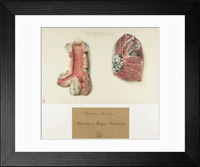 Framed Print : 13741463 Framed Print : 13741463