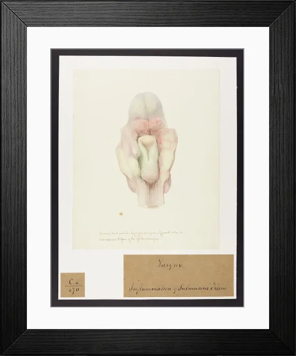 Framed Print : 13741466 Framed Print : 13741466
