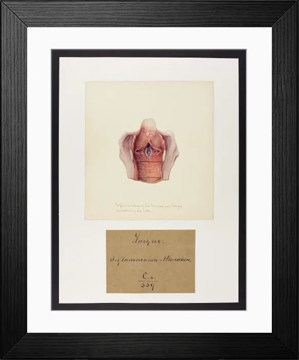 Framed Print : 13741474 Framed Print : 13741474