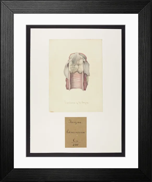 Framed Print : 13741476 Framed Print : 13741476