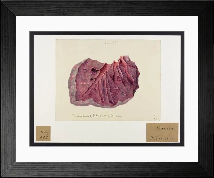Framed Print : 13741597 Framed Print : 13741597