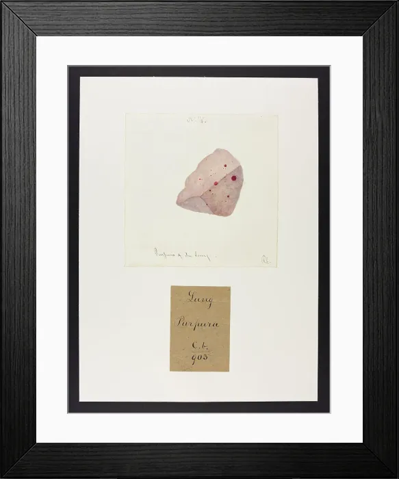 Framed Print : 13741612 Framed Print : 13741612