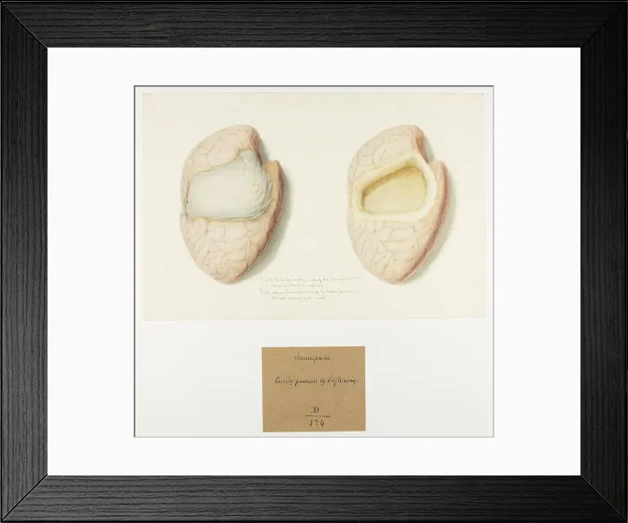 Framed Print : 13741638 Framed Print : 13741638