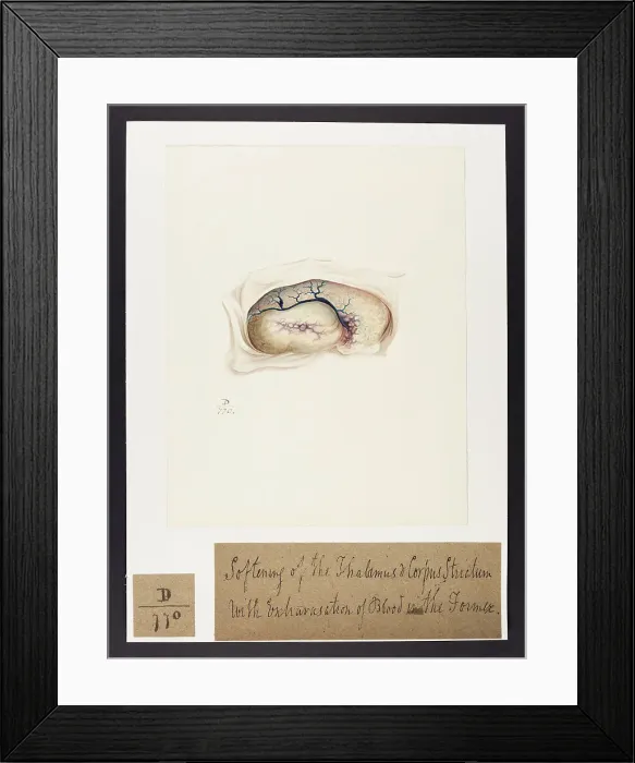 Framed Print : 13741693 Framed Print : 13741693