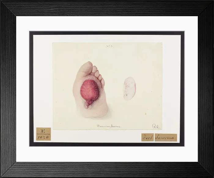 Framed Print : 13741719 Framed Print : 13741719