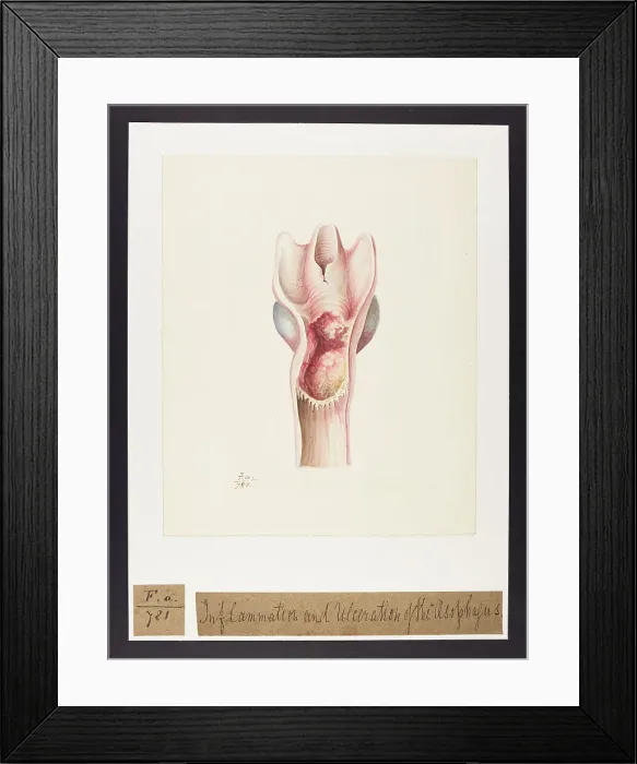 Framed Print : 13741752 Framed Print : 13741752