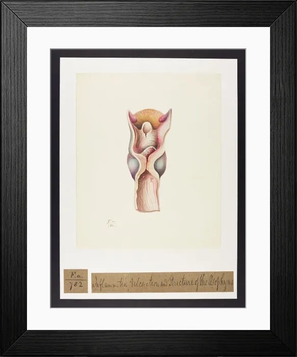 Framed Print : 13741753 Framed Print : 13741753