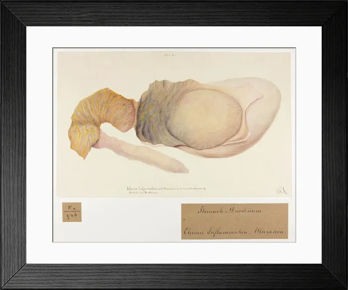 Framed Print : 13741761 Framed Print : 13741761