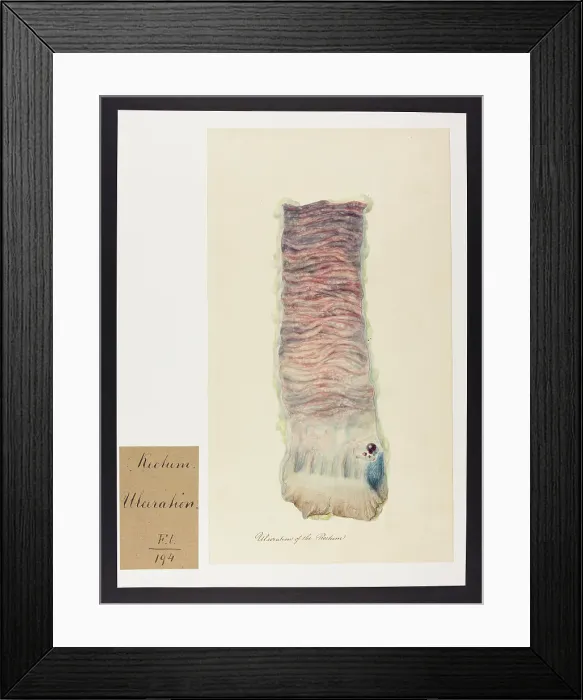 Framed Print : 13741793 Framed Print : 13741793