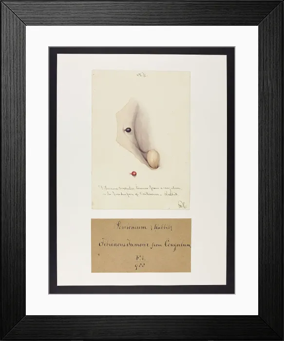 Framed Print : 13741849 Framed Print : 13741849