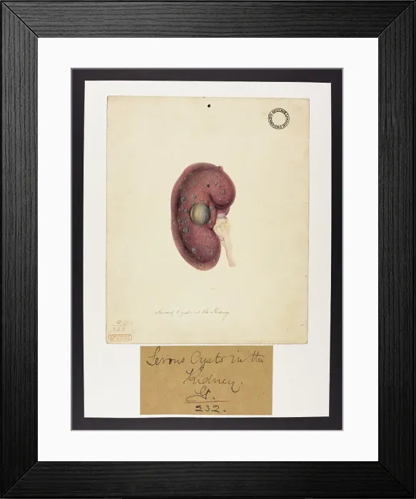 Framed Print : 13741949 Framed Print : 13741949