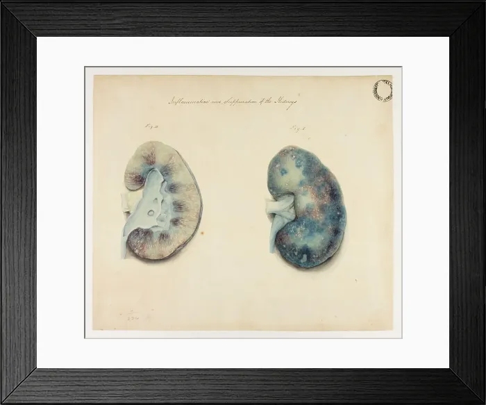 Framed Print : 13741951 Framed Print : 13741951