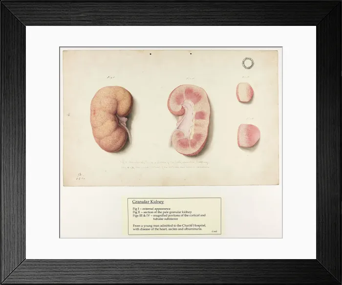 Framed Print : 13741969 Framed Print : 13741969