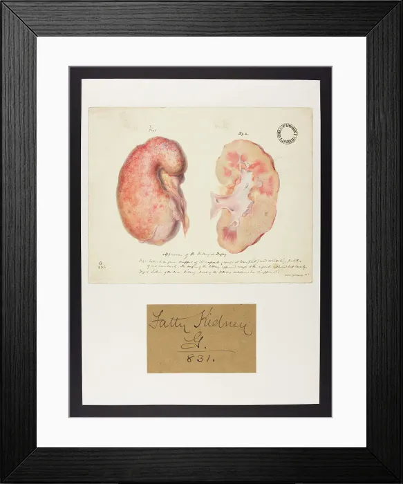 Framed Print : 13741975