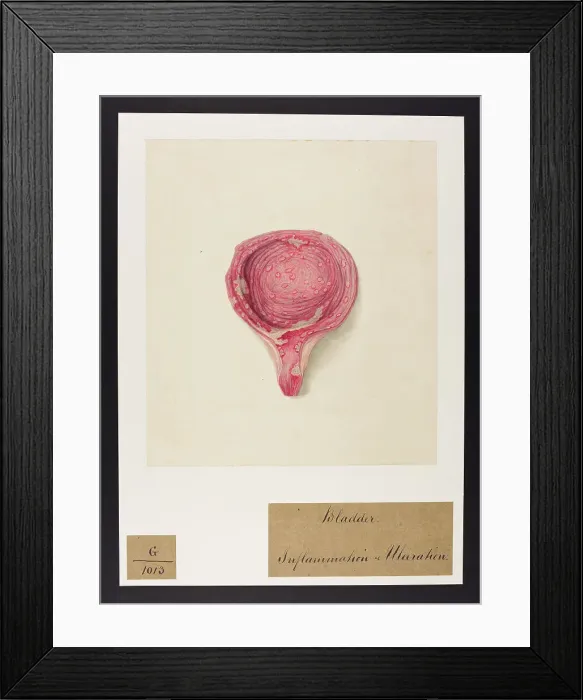 Framed Print : 13741990 Framed Print : 13741990