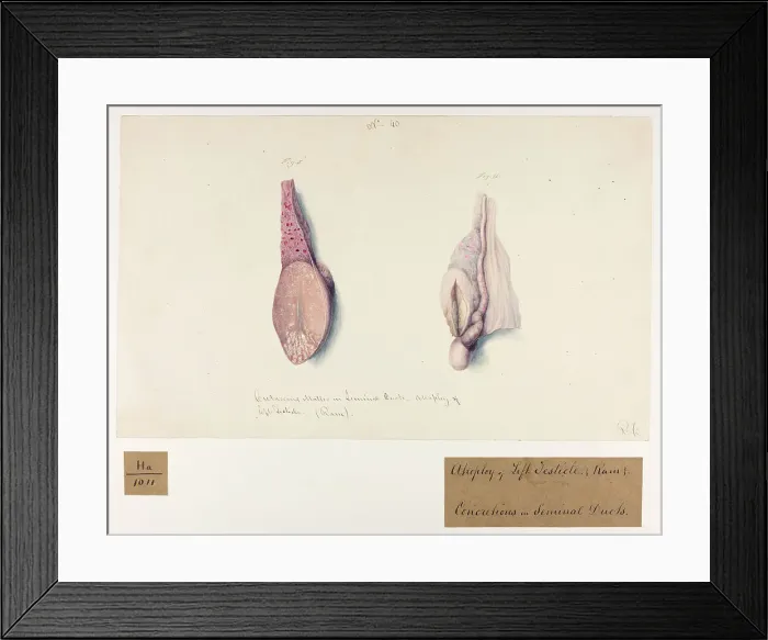 Framed Print : 13742006 Framed Print : 13742006