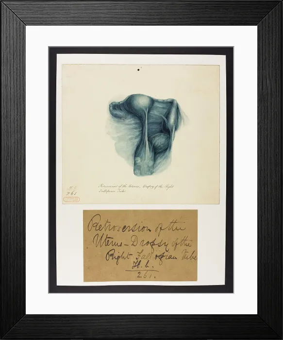 Framed Print : 13742011 Framed Print : 13742011