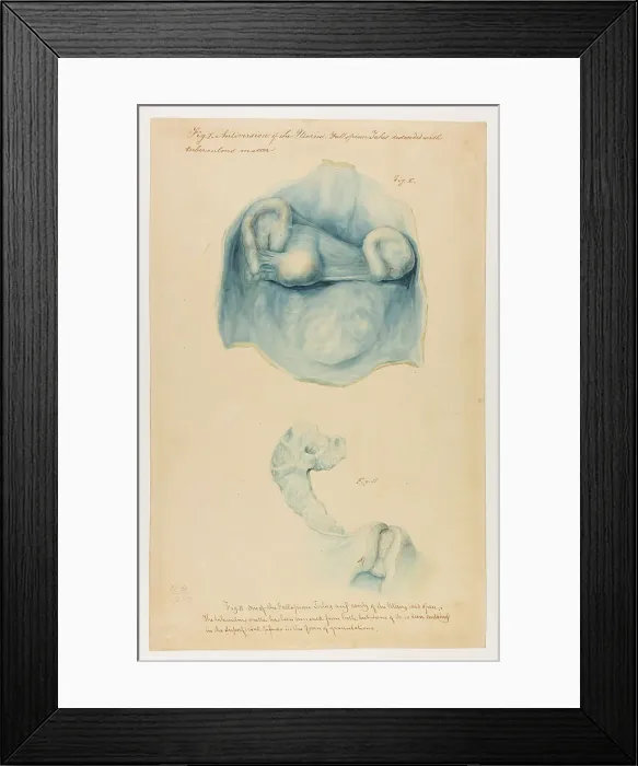 Framed Print : 13742013 Framed Print : 13742013