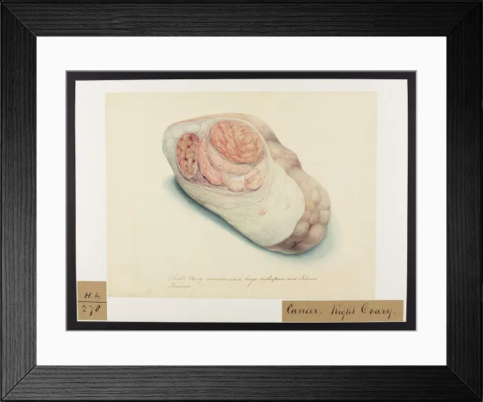 Framed Print : 13742020 Framed Print : 13742020