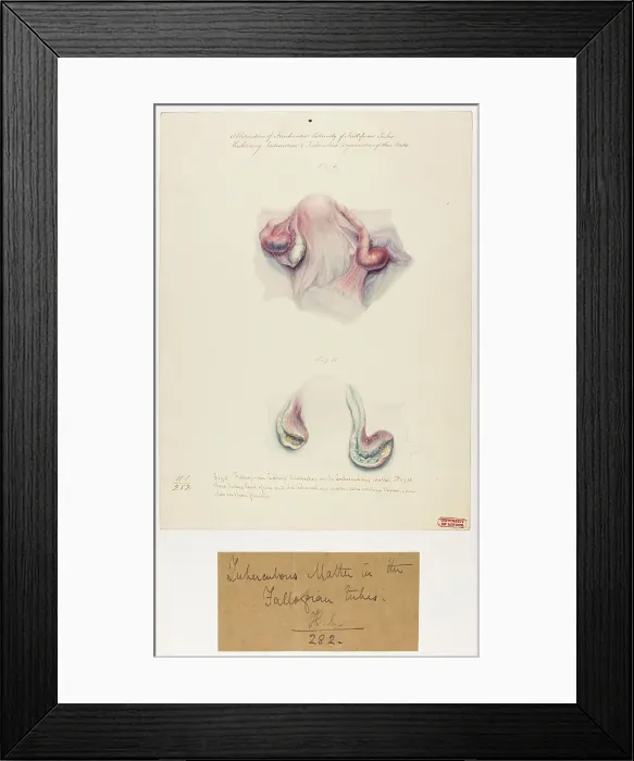Framed Print : 13742021 Framed Print : 13742021