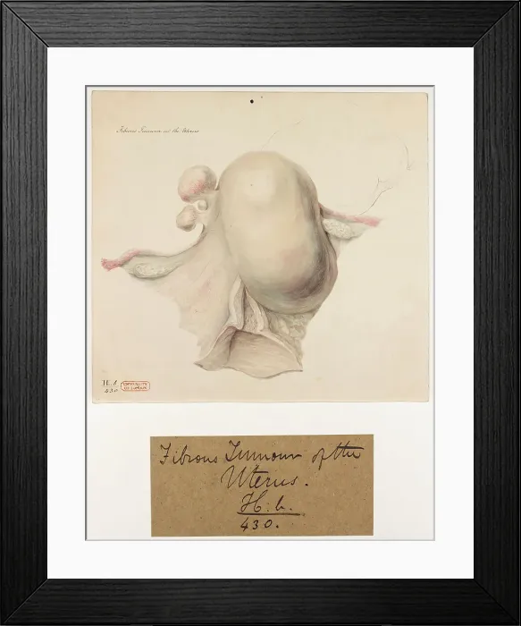 Framed Print : 13742024 Framed Print : 13742024