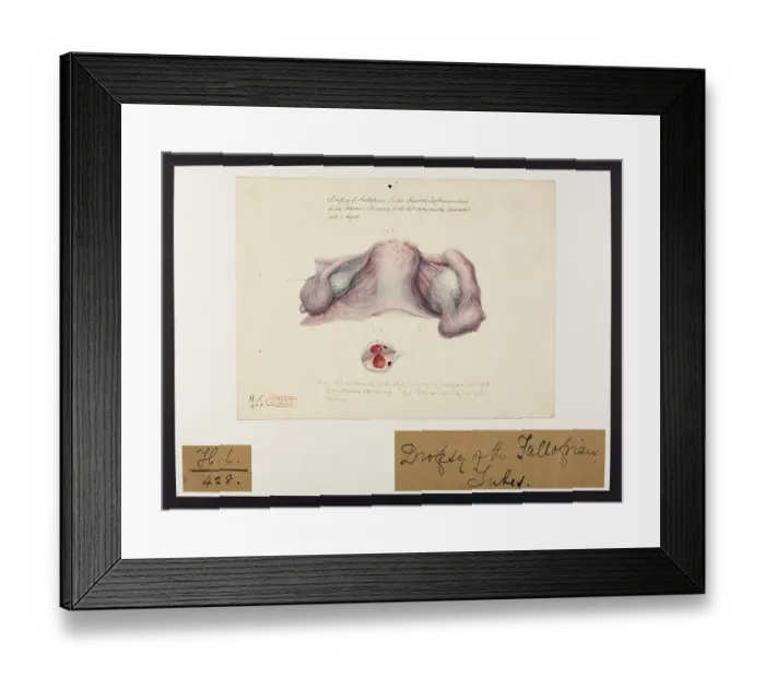 Framed Print : 13742023 Framed Print : 13742023