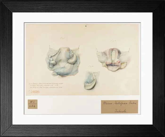 Framed Print : 13742028 Framed Print : 13742028