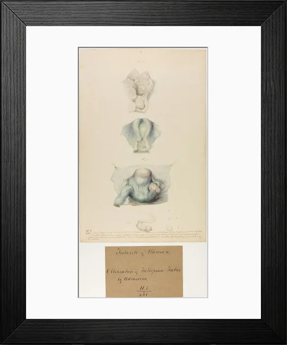Framed Print : 13742032 Framed Print : 13742032