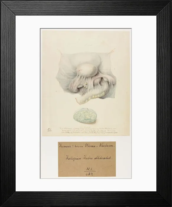 Framed Print : 13742033 Framed Print : 13742033
