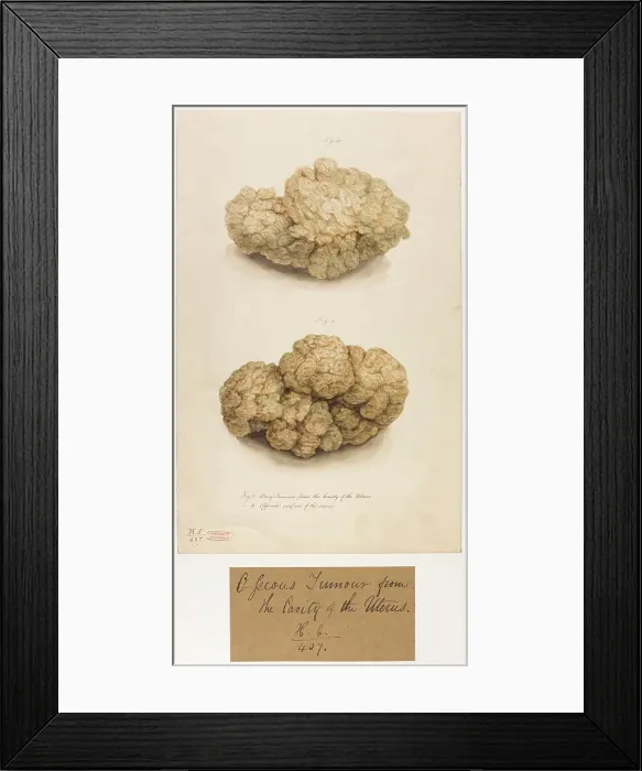 Framed Print : 13742031 Framed Print : 13742031