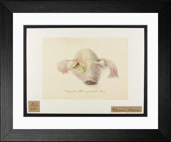 Framed Print : 13742036 Framed Print : 13742036