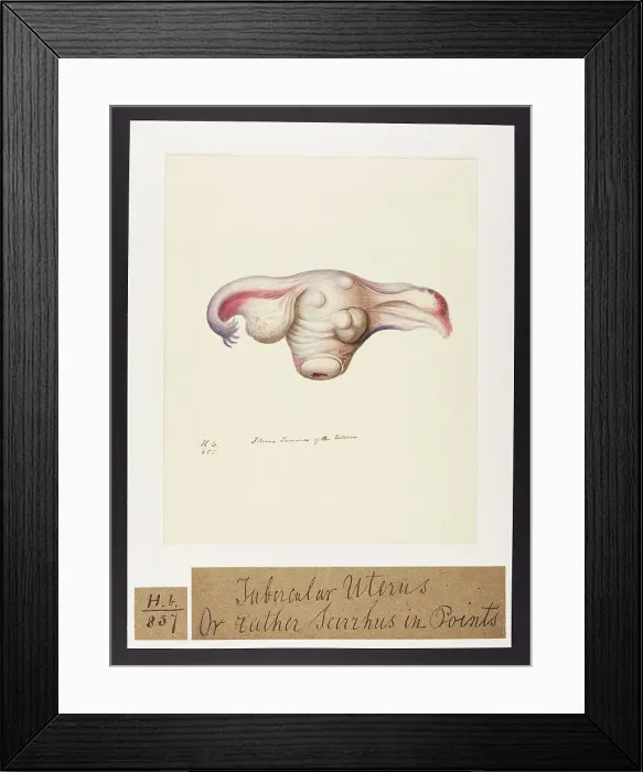 Framed Print : 13742049 Framed Print : 13742049