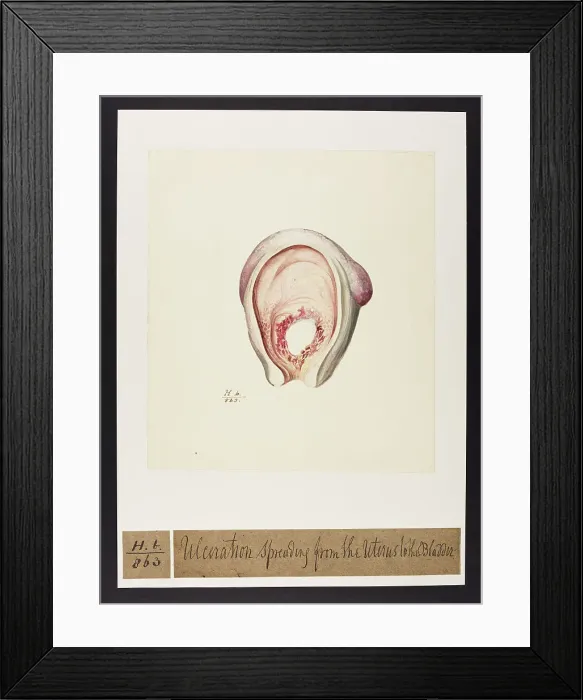 Framed Print : 13742055 Framed Print : 13742055