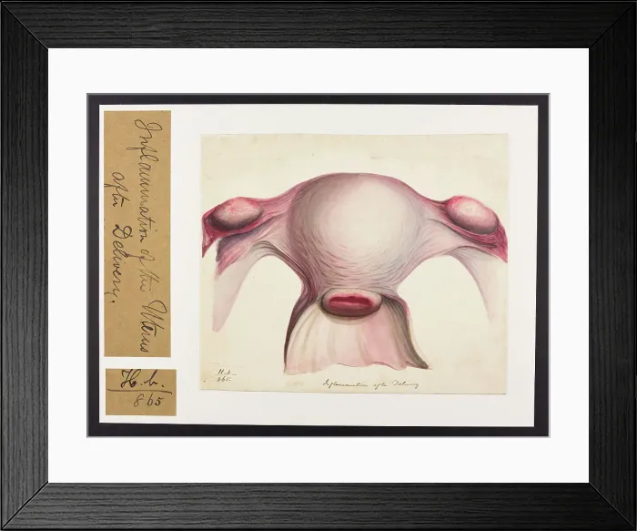 Framed Print : 13742057 Framed Print : 13742057