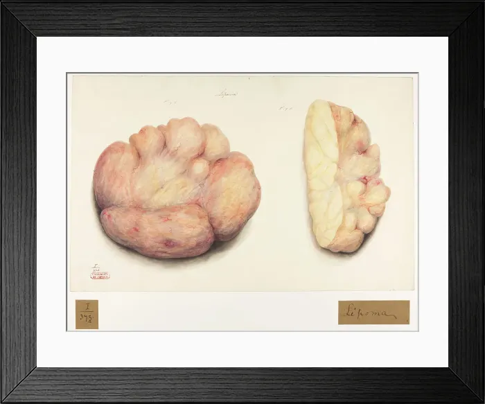 Framed Print : 13742083 Framed Print : 13742083