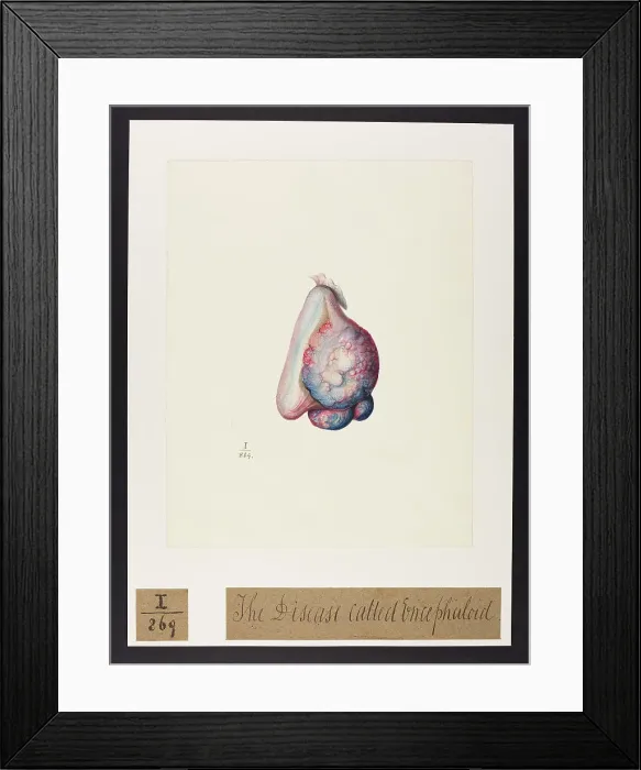 Framed Print : 13742088 Framed Print : 13742088