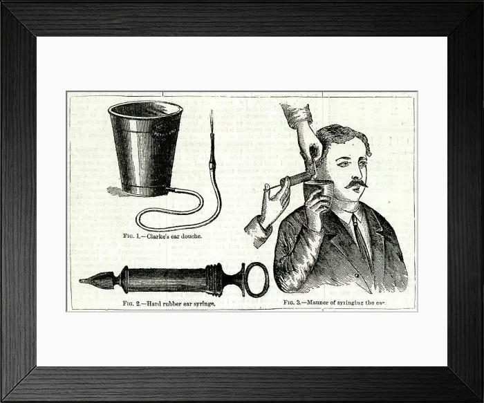 Framed Print : Doctor syringing a patient's ear Framed Print : Doctor syringing a patient's ear