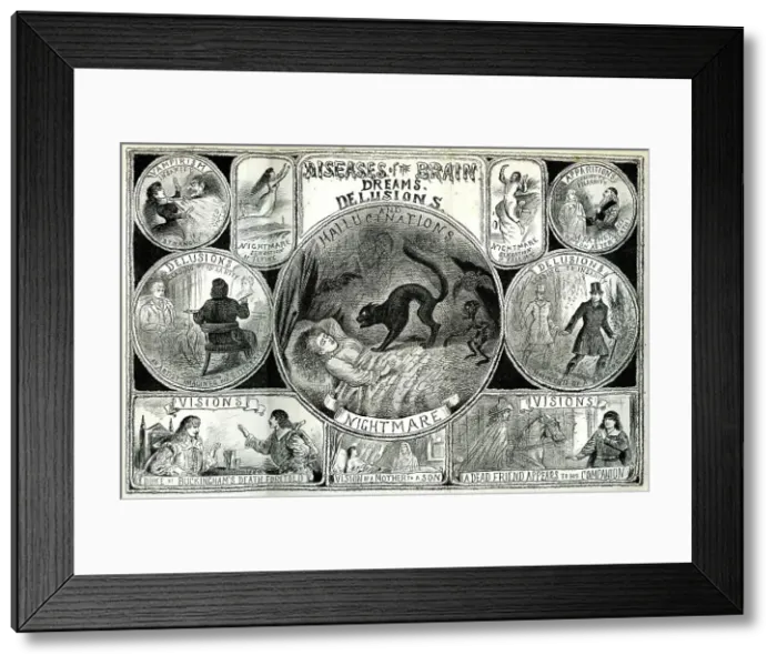 Framed Print : Diseases of the Brain Framed Print : Diseases of the Brain