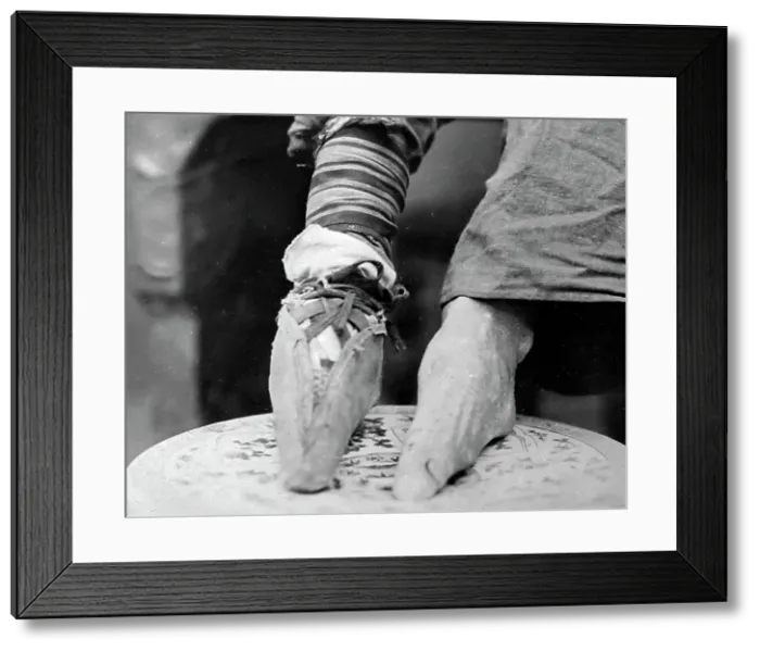 Framed Print : Bound feet, China, early 1900s Framed Print : Bound feet, China, early 1900s