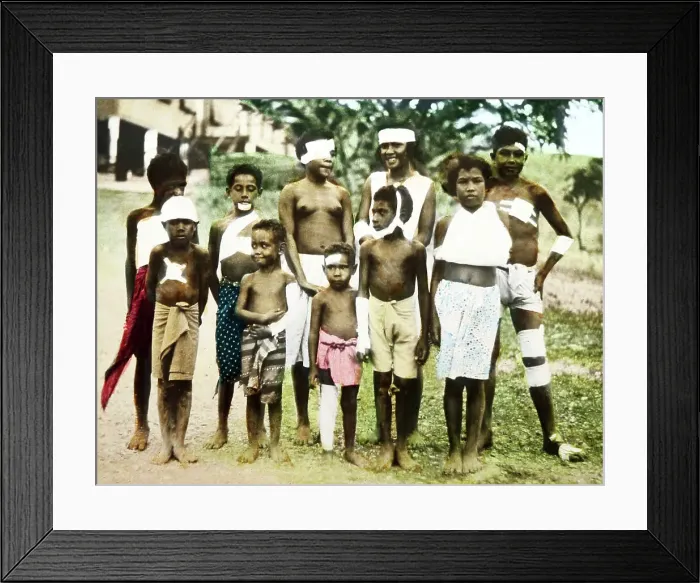 Framed Print : Patients at a Mission Hospital, Port Moresby, PNG Framed Print : Patients at a Mission Hospital, Port Moresby, PNG