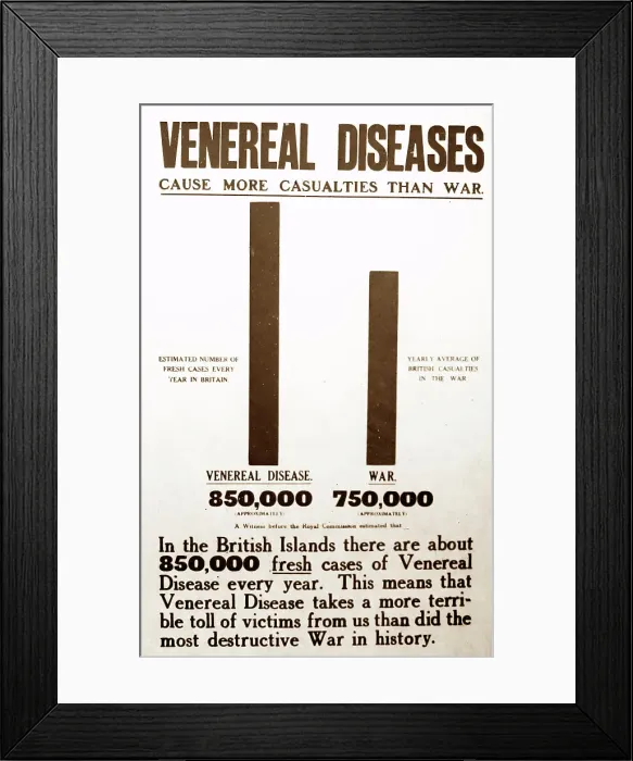 Framed Print : Venereal Disease, 1920s projection slide Framed Print : Venereal Disease, 1920s projection slide
